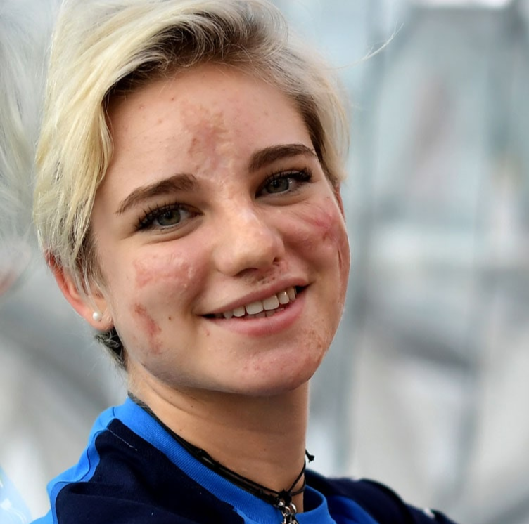 Bebe Vio Michela Noris By Michela Noris 7714 On Genially