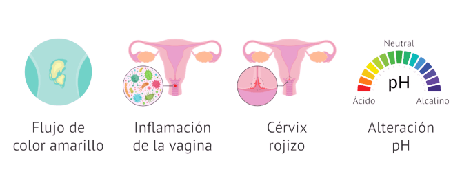 10 Enfermedades Del Sistema Reproductor Femenino view.genially.com